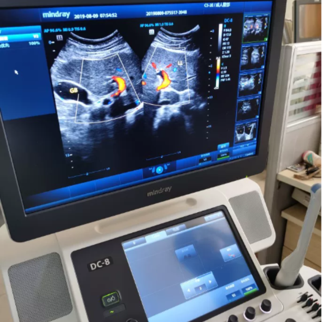 迈瑞彩超维修迈瑞DC-8 Mindray 编码器 按键 控制面板主板 通道板 维修(图5)